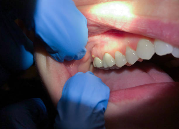 Best Dentist Open Late Near Me  in Russellville, AL