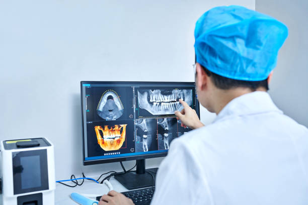 Best Chipped Tooth Repair Near Me  in Russellville, AL